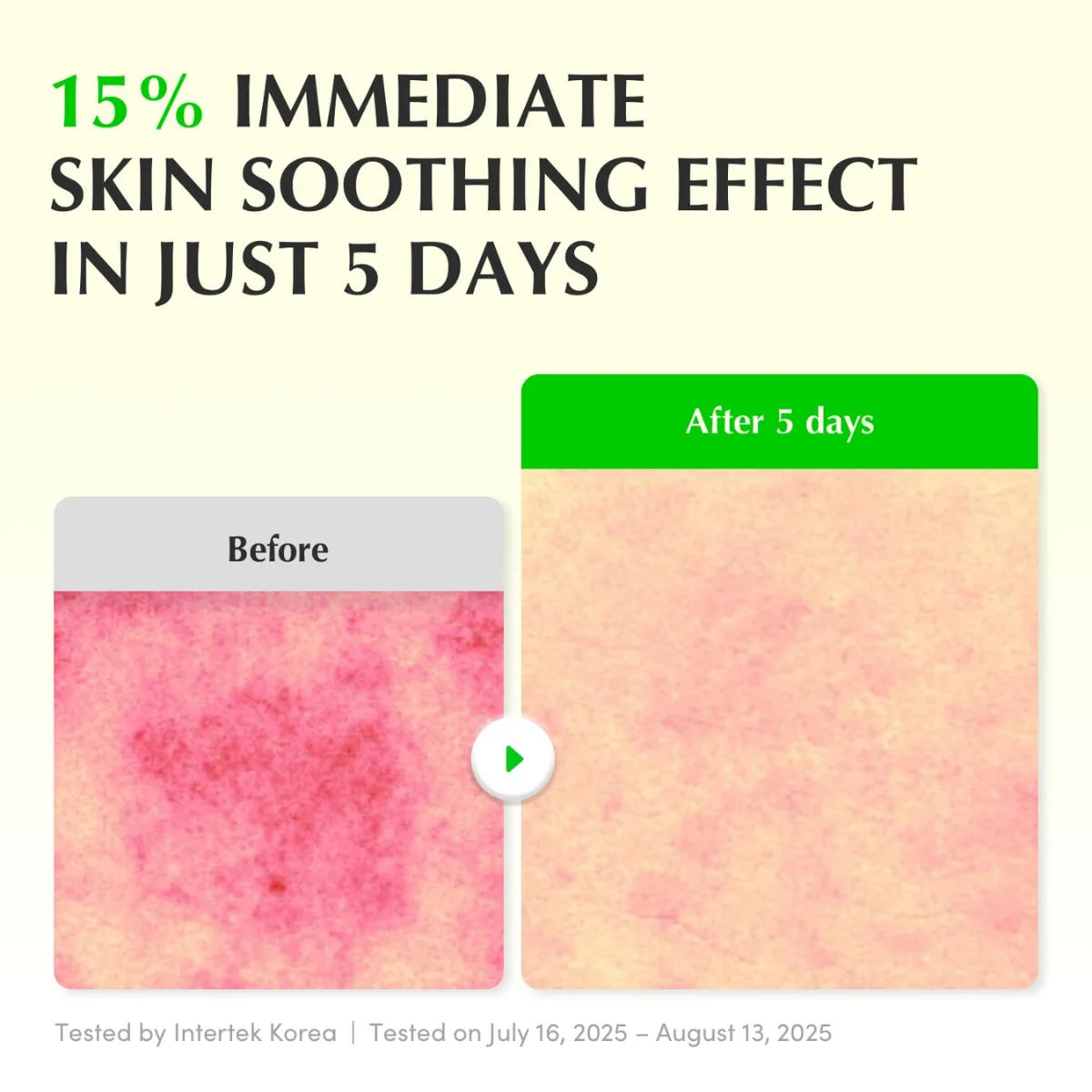Sérum Calmante à l’Aloe PDRN 30 ml