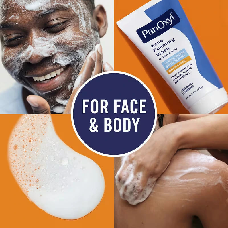 PanOxyl, Acne Foaming Wash For Face & Body, Maximum Strength - 85 g