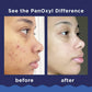 PanOxyl, Acne Foaming Wash For Face & Body, Maximum Strength - 85 g